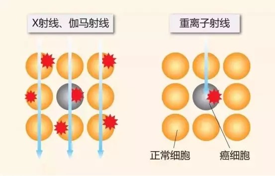 質(zhì)子重離子技術(shù)醫(yī)療險(xiǎn)可以報(bào)銷嗎？